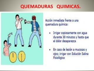 QUEMADURAS QUIMICAS. 
 