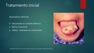 Tratamiento inicial
Quemaduras eléctricas
 Desconectar la corriente eléctrica
 Retirar al paciente
 Utilizar materiales no conductores
MINISTERIO DE SALUD. Guía Clínica. Manejo del paciente gran quemado. Santiago: Minsal, 2016
 