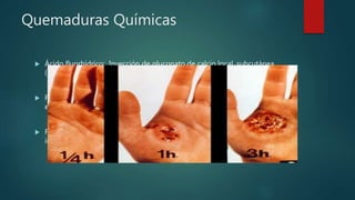 Quemaduras Químicas
 Ácido fluorhídrico: Inyección de gluconato de calcio local, subcutánea
(1cc/cm2 de superficie quemada) y/o sistémica.
 Fósforo: Requiere irrigación y eliminación inmediata, para lo cual se utiliza
el sulfato de cobre que permite su rápida identificación.
 Fenol: Neutralizar con alcohol etílico o polietilenglicol al 30%, y luego
irrigar
 