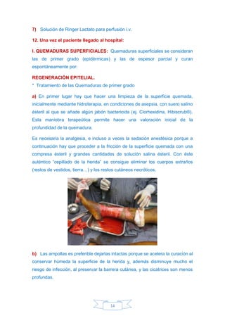 14
7) Solución de Ringer Lactato para perfusión i.v.
12. Una vez el paciente llegado al hospital:
I. QUEMADURAS SUPERFICIALES: Quemaduras superficiales se consideran
las de primer grado (epidérmicas) y las de espesor parcial y curan
espontáneamente por:
REGENERACIÓN EPITELIAL.
* Tratamiento de las Quemaduras de primer grado
a) En primer lugar hay que hacer una limpieza de la superficie quemada,
inicialmente mediante hidroterapia, en condiciones de asepsia, con suero salino
ésteril al que se añade algún jabón bactericida (ej. Clorhexidina, Hibiscrub®).
Esta maniobra terapeútica permite hacer una valoración inicial de la
profundidad de la quemadura.
Es necesaria la analgesia, e incluso a veces la sedación anestésica porque a
continuación hay que proceder a la fricción de la superficie quemada con una
compresa ésteril y grandes cantidades de solución salina ésteril. Con éste
auténtico “cepillado de la herida” se consigue eliminar los cuerpos extraños
(restos de vestidos, tierra…) y los restos cutáneos necróticos.
b) Las ampollas es preferible dejarlas intactas porque se acelera la curación al
conservar húmeda la superficie de la herida y, además disminuye mucho el
riesgo de infección, al preservar la barrera cutánea, y las cicatrices son menos
profundas.
 