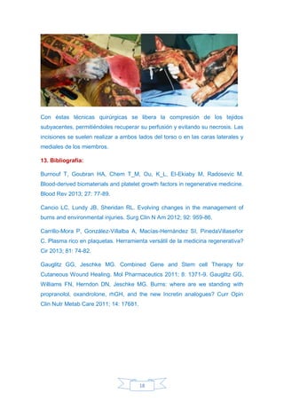 18
Con éstas técnicas quirúrgicas se libera la compresión de los tejidos
subyacentes, permitiéndoles recuperar su perfusión y evitando su necrosis. Las
incisiones se suelen realizar a ambos lados del torso o en las caras laterales y
mediales de los miembros.
13. Bibliografía:
Burnouf T, Goubran HA, Chem T_M, Ou, K_L, El-Ekiaby M, Radosevic M.
Blood-derived biomaterials and platelet growth factors in regenerative medicine.
Blood Rev 2013; 27: 77-89.
Cancio LC, Lundy JB, Sheridan RL. Evolving changes in the management of
burns and environmental injuries. Surg Clin N Am 2012; 92: 959-86.
Carrillo-Mora P, González-Villalba A, Macías-Hernández SI, PinedaVillaseñor
C. Plasma rico en plaquetas. Herramienta versátil de la medicina regenerativa?
Cir 2013; 81: 74-82.
Gauglitz GG, Jeschke MG. Combined Gene and Stem cell Therapy for
Cutaneous Wound Healing. Mol Pharmaceutics 2011; 8: 1371-9. Gauglitz GG,
Williams FN, Herndon DN, Jeschke MG. Burns: where are we standing with
propranolol, oxandrolone, rhGH, and the new Incretin analogues? Curr Opin
Clin Nutr Metab Care 2011; 14: 17681.
 