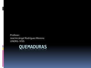 QUEMADURAS
Profesor:
JoséArcángel Rodríguez Moreno
UNERG- IVSS
 