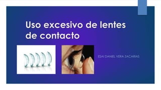 Uso excesivo de lentes
de contacto
ESAI DANIEL VERA ZACARIAS
 