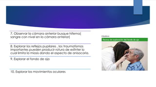 7. Observar la cámara anterior busque hifema(
sangre con nivel en la cámara anterior)
8. Explorar los reflejos pupilares , los traumatismos
importantes pueden producir rotura de esfínter lo
cual limita la miosis dando el aspecto de anisocoria.
9. Explorar el fondo de ojo
10. Explorar los movimientos oculares
 