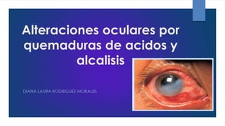 Alteraciones oculares por
quemaduras de acidos y
alcalisis
DIANA LAURA RODRIGUEZ MORALES
 
