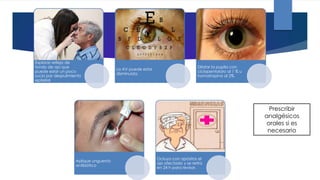 Explorar reflejo de
fondo de ojo que
puede estar un poco
sucio por despulimiento
epitelial
La AV puede estar
disminuida.
Dilatar la pupila con
ciclopentolato al 1 % u
homatropina al 2%.
Aplique unguento
antibiótico
Ocluya con apósitos el
ojo afectado y se retira
en 24 h para revisar.
Prescribir
analgésicos
orales si es
necesario
 