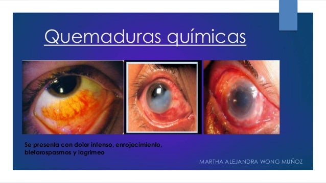 urgencias ofalmlogicas