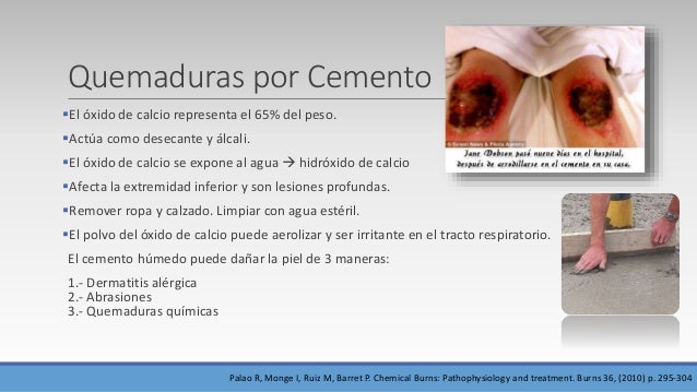 Que síntomas en las articulaciones a la psoriasis