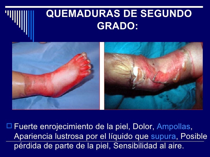 La crema que blanquea el precio
