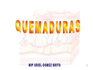 QUEMADURAS MIP URIEL GOMEZ BRITO 