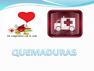     QUEMADURAS 