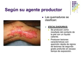 Según su agente productor
                   Las quemaduras se
                    clasifican:

                       ESCALDADURAS:
                           Se producen como
                            resultado del contacto de
                            la piel con un líquido
                            caliente.
                           Producen lesiones
                            características con
                            aparición rápida de signos
                            de lesiones de segundo
                            grado profundo en escaso
                            tiempo de exposición.
 