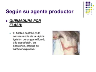 Según su agente productor
   QUEMADURA POR
    FLASH:

       El flash o destello es la
        consecuencia de la rápida
        ignición de un gas o líquido
        a lo que añadir , en
        ocasiones, efectos de
        carácter explosivo.
 