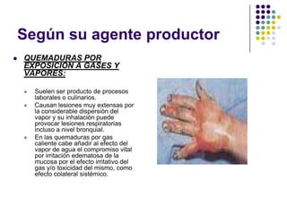 Según su agente productor
   QUEMADURAS POR
    EXPOSICIÓN A GASES Y
    VAPORES:

       Suelen ser producto de procesos
        laborales o culinarios.
       Causan lesiones muy extensas por
        la considerable dispersión del
        vapor y su inhalación puede
        provocar lesiones respiratorias
        incluso a nivel bronquial.
       En las quemaduras por gas
        caliente cabe añadir al efecto del
        vapor de agua el compromiso vital
        por irritación edematosa de la
        mucosa por el efecto irritativo del
        gas y/o toxicidad del mismo, como
        efecto colateral sistémico.
 