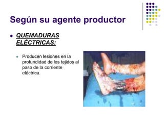Según su agente productor
   QUEMADURAS
    ELÉCTRICAS:

       Producen lesiones en la
        profundidad de los tejidos al
        paso de la corriente
        eléctrica.
 