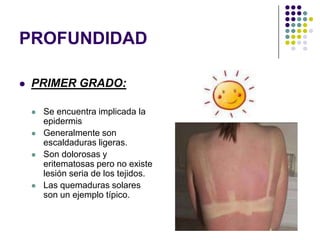 PROFUNDIDAD

   PRIMER GRADO:

       Se encuentra implicada la
        epidermis
       Generalmente son
        escaldaduras ligeras.
       Son dolorosas y
        eritematosas pero no existe
        lesión seria de los tejidos.
       Las quemaduras solares
        son un ejemplo típico.
 