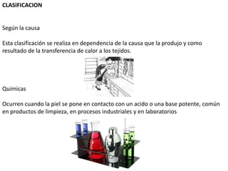 CLASIFICACION


Según la causa

Esta clasificación se realiza en dependencia de la causa que la produjo y como
resultado de la transferencia de calor a los tejidos.




Químicas

Ocurren cuando la piel se pone en contacto con un acido o una base potente, común
en productos de limpieza, en procesos industriales y en laboratorios
 