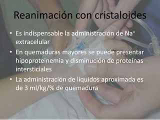 Reanimación con cristaloides
• Es indispensable la administración de Na+
  extracelular
• En quemaduras mayores se puede presentar
  hipoproteinemia y disminución de proteínas
  intersticiales
• La administración de líquidos aproximada es
  de 3 ml/kg/% de quemadura
 
