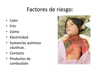 Factores de riesgo:
• Calor
• Frío
• Llama
• Electricidad
• Sustancias químicas
  cáusticas.
• Contacto
• Productos de
  combustión
 
