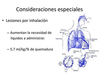 Consideraciones especiales
• Lesiones por inhalación

  – Aumentan la necesidad de
    líquidos a administrar.

  – 5.7 ml/kg/% de quemadura
 