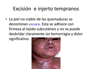 Excisión e injerto tempranos
• La piel no viable de las quemaduras se
  denominan escara. Esta se adhiere con
  firmeza al tejido subcutáneo y no se puede
  desbridar claramente sin hemorragia y dolor
  significativo.
 