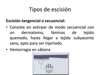 Tipos de escisión
Escisión tangencial o secuencial:
• Consiste en extirpar de modo secuencial con
  un     dermatomo,       láminas de   tejido
  quemado, hasta llegar a tejido subyacente
  sano, apto para ser injertado.
• Hemorragia en sábana
 
