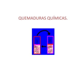QUEMADURAS QUÍMICAS.
 