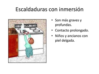 Escaldaduras con inmersión
             • Son más graves y
               profundas.
             • Contacto prolongado.
             • Niños y ancianos con
               piel delgada.
 