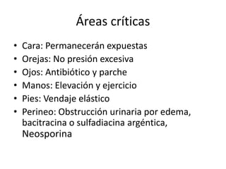 Áreas críticas
•   Cara: Permanecerán expuestas
•   Orejas: No presión excesiva
•   Ojos: Antibiótico y parche
•   Manos: Elevación y ejercicio
•   Pies: Vendaje elástico
•   Perineo: Obstrucción urinaria por edema,
    bacitracina o sulfadiacina argéntica,
    Neosporina
 