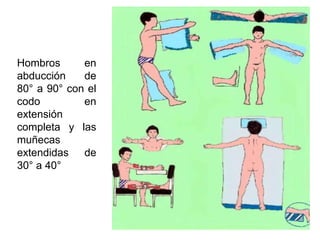 Hombros      en
abducción    de
80° a 90° con el
codo         en
extensión
completa y las
muñecas
extendidas de
30° a 40°
 