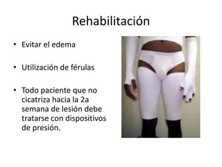 Rehabilitación
• Evitar el edema

• Utilización de férulas

• Todo paciente que no
  cicatriza hacia la 2a
  semana de lesión debe
  tratarse con dispositivos
  de presión.
 