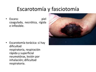 Escarotomía y fasciotomía
• Escara:                 piel
  coagulada, necrótica, rígida
  e inflexible.




• Escarotomía torácica: si hay
  dificultad
  respiratoria, respiración
  rápida y superficial
  neumotórax, lesión por
  inhalación; dificultad
  respiratoria.
 