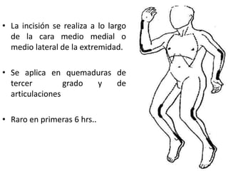 • La incisión se realiza a lo largo
  de la cara medio medial o
  medio lateral de la extremidad.

• Se aplica en quemaduras de
  tercer         grado y  de
  articulaciones

• Raro en primeras 6 hrs..
 
