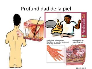 Profundidad de la piel
 