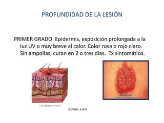 PROFUNDIDAD DE LA LESIÓN


PRIMER GRADO: Epidermis, exposición prolongada a la
  luz UV o muy breve al calor. Color rosa o rojo claro.
  Sin ampollas, curan en 2 o tres días. Tx sintomático.
 