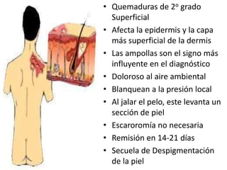 • Quemaduras de 2o grado
  Superficial
• Afecta la epidermis y la capa
  más superficial de la dermis
• Las ampollas son el signo más
  influyente en el diagnóstico
• Doloroso al aire ambiental
• Blanquean a la presión local
• Al jalar el pelo, este levanta un
  sección de piel
• Escaroromía no necesaria
• Remisión en 14-21 días
• Secuela de Despigmentación
  de la piel
 