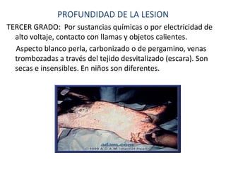 PROFUNDIDAD DE LA LESION
TERCER GRADO: Por sustancias químicas o por electricidad de
  alto voltaje, contacto con llamas y objetos calientes.
  Aspecto blanco perla, carbonizado o de pergamino, venas
  trombozadas a través del tejido desvitalizado (escara). Son
  secas e insensibles. En niños son diferentes.
 