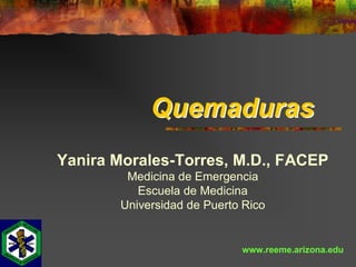 Quemaduras 
Yanira Morales­Torres, M.D., FACEP 
         Medicina de Emergencia 
           Escuela de Medicina 
        Universidad de Puerto Rico


                             www.reeme.arizona.edu 
 