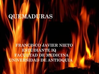 QUEMADURAS




  FRANCISCO JAVIER NIETO
     ESTUDIANTE IQ
  FACULTAD DE MEDICINA
UNIVERSIDAD DE ANTIOQUIA
 