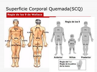 Superficie Corporal Quemada(SCQ)
 Regla de los 9 de Wallace


•Es la cantidad de piel o % de cuerpo que sufrió
quemadura.
•Nos sirve para evaluar la severidad de la quemadura
•Determinara el tipo de atención que la persona
quemada requiere
   •Primeros auxilios y tratamiento ambulatorio
   •Hospitalización o atención de urgencia
•Es la forma mas confiable de evaluar al paciente.
 