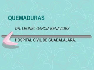 QUEMADURAS DR. LEONEL GARCIA BENAVIDES   HOSPITAL CIVIL DE GUADALAJARA. 