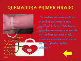 QUEMADURA PRIMER GRADO
Se considera de primer grado a la
quemadura que lesiona la capa
superficial de la piel. Este tipo de
quemadura generalmente es causada
por una larga exposición al sol, o
exposición instantánea a otra forma
de calor (plancha, líquidos
calientes)
Síntomas
•Enrojecimiento de la piel.
•Piel seca.
•Dolor intenso tipo ardor.
•Inflamación moderada.
•Gran sensibilidad en el lugar de la
lesión.
 