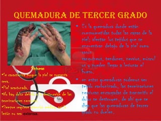 QUEMADURA DE TERCER GRADO
• Es la quemadura donde están
comprometidas todas las capas de la
piel; afectan los tejidos que se
encuentran debajo de la piel como
vasos
sanguíneos, tendones, nervios, múscul
os y pueden llegar a lesionar el
hueso.
• en estas quemaduras podemos ver
tejido carbonizado, las terminaciones
nerviosas encargadas de transmitir el
dolor se destruyen, de ahí que se
diga que las quemaduras de tercer
grado no duelen.
Síntomas
•Se caracteriza porque la piel se presenta
seca.
•Piel acartonada.
•No hay dolor debido a la destrucción de las
terminaciones nerviosas.
•Siempre requiere atención médica, así la
lesión no sea extensa.
 