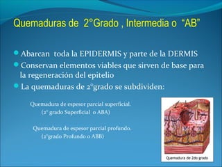 Quemaduras de 2°Grado , Intermedia o “AB”
Abarcan toda la EPIDERMIS y parte de la DERMIS
Conservan elementos viables que sirven de base para

la regeneración del epitelio
La quemaduras de 2°grado se subdividen:
Quemadura de espesor parcial superficial.
(2° grado Superficial o ABA)
Quemadura de espesor parcial profundo.
(2°grado Profundo o ABB)

 