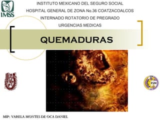 INSTITUTO MEXICANO DEL SEGURO SOCIAL
HOSPITAL GENERAL DE ZONA No.36 COATZACOALCOS
INTERNADO ROTATORIO DE PREGRADO
URGENCIAS MEDICAS

QUEMADURAS

MIP: VARELA MONTES DE OCA DANIEL

 
