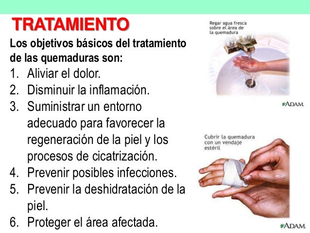 Quemaduras De Primer Grado Tratamiento - Reverasite