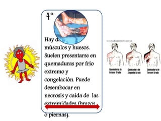 4° 
Hay daños de 
músculos y huesos. 
Suelen presentarse en 
quemaduras por frío 
extremo y 
congelación. Puede 
desembocar en 
necrosis y caída de las 
extremidades (brazos 
o piernas). 
 