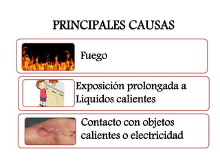 PRINCIPALES CAUSAS 
Fuego 
Exposición prolongada a 
Liquidos calientes 
Contacto con objetos 
calientes o electricidad 
