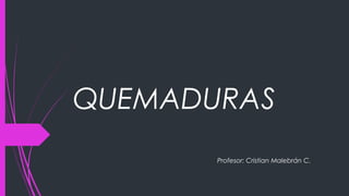 QUEMADURAS 
Profesor: Cristian Malebrán C. 
 