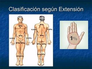 Clasificación según ExtensiónClasificación según Extensión
 